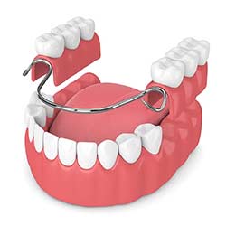 Partial Dentures in North Austin