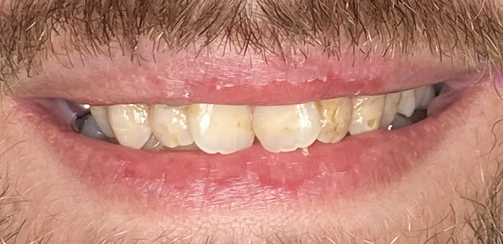 Before